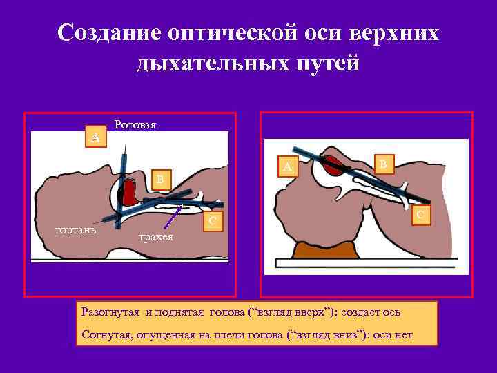 Создание оптической оси верхних дыхательных путей A Ротовая полость A B B гортань C