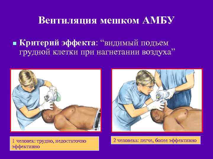 Вентиляция мешком АМБУ n Критерий эффекта: “видимый подъем грудной клетки при нагнетании воздуха” 1