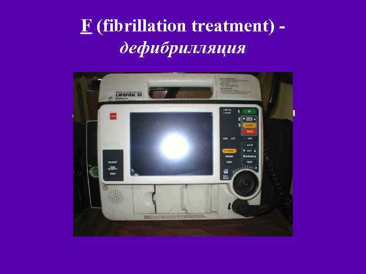 F (fibrillation treatment) дефибрилляция В большинстве рекомендаций дефибрилляции отводится ведущая и первоначальная роль 