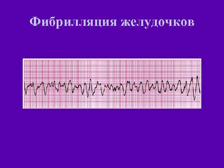 Фар слр рекомендации