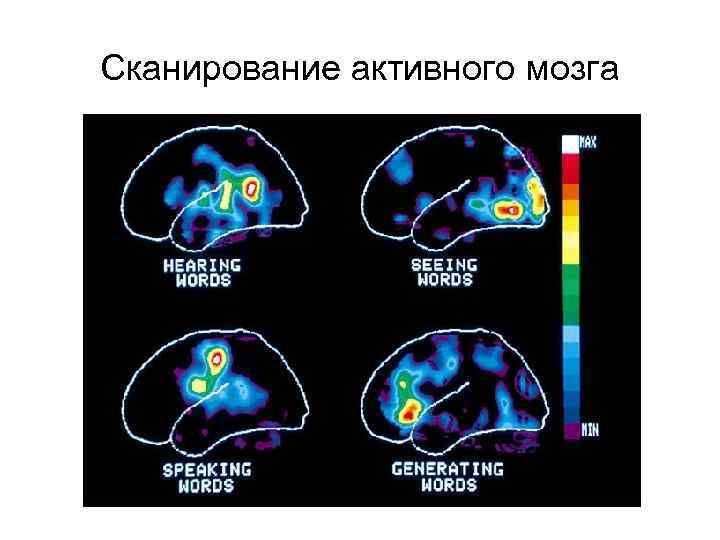 Сканирование активного мозга 