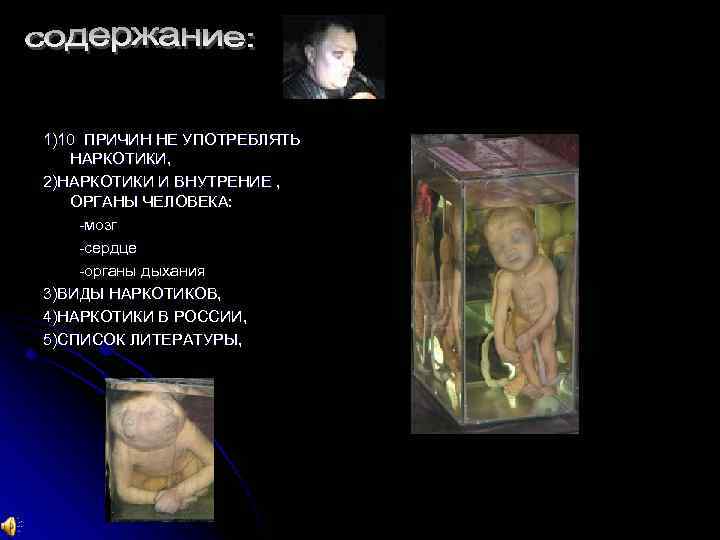 1)10 ПРИЧИН НЕ УПОТРЕБЛЯТЬ НАРКОТИКИ, 2)НАРКОТИКИ И ВНУТРЕНИЕ , ОРГАНЫ ЧЕЛОВЕКА: мозг сердце органы