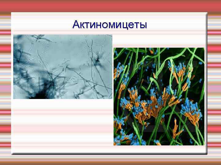 Актиномицеты 