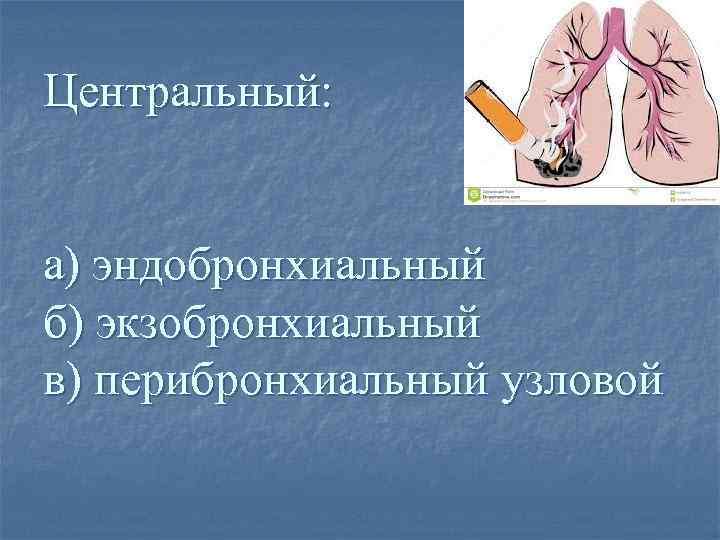 Центральный: а) эндобронхиальный б) экзобронхиальный в) перибронхиальный узловой 