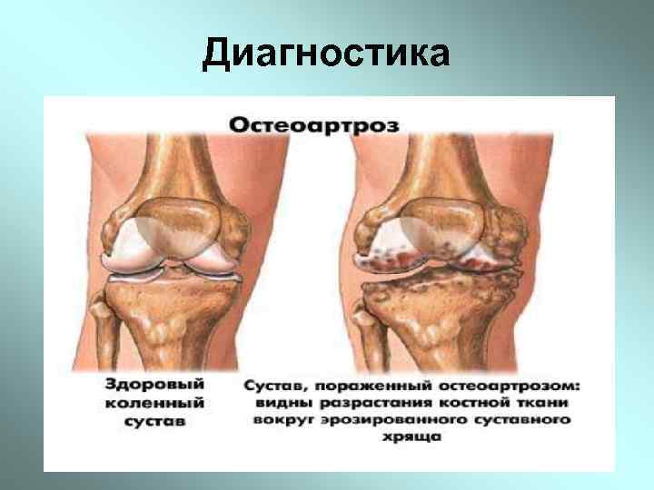 Диагностика 