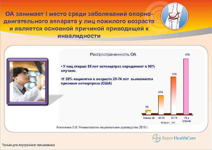 ОА занимает I место среди заболеваний опорнодвигательного аппарата у лиц пожилого возраста и является