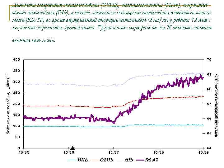 Динамика содержания оксигемоглобина (O 2 Hb), дезоксигемоглобина (HHb), содержания общего гемоглобина (t. Hb), а