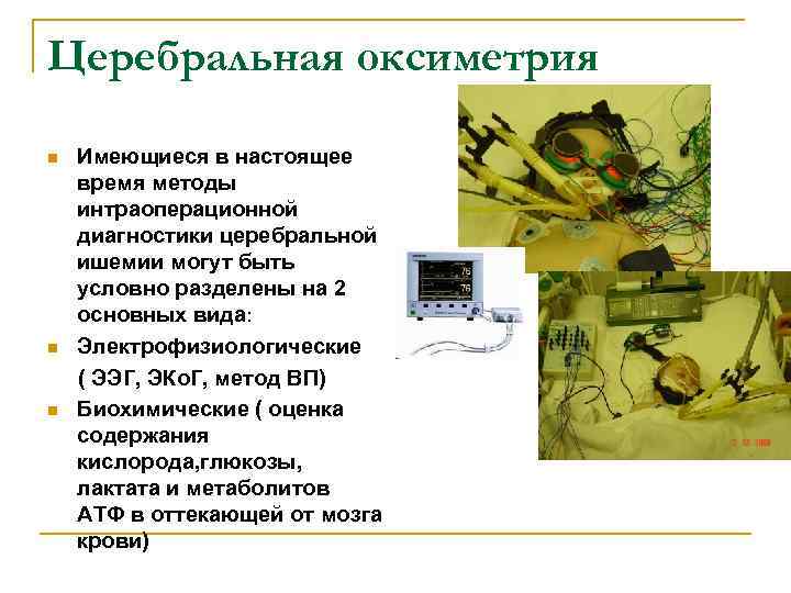 Церебральная оксиметрия Имеющиеся в настоящее время методы интраоперационной диагностики церебральной ишемии могут быть условно