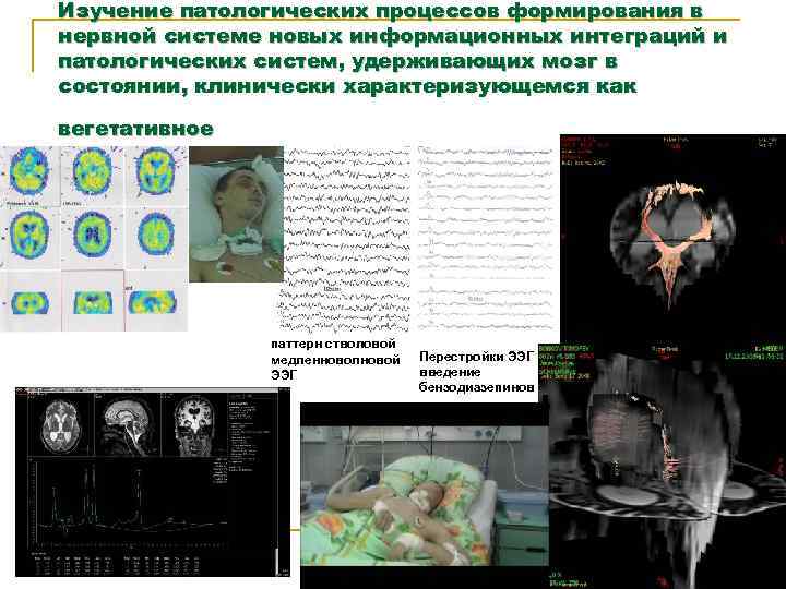 Изучение патологических процессов формирования в нервной системе новых информационных интеграций и патологических систем, удерживающих