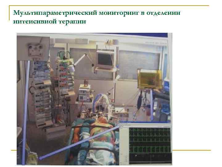 Мультипараметрический мониторинг в отделении интенсивной терапии 