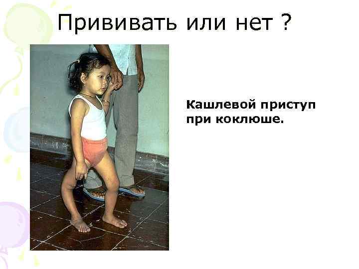 Прививать или нет ? Кашлевой приступ при коклюше. 