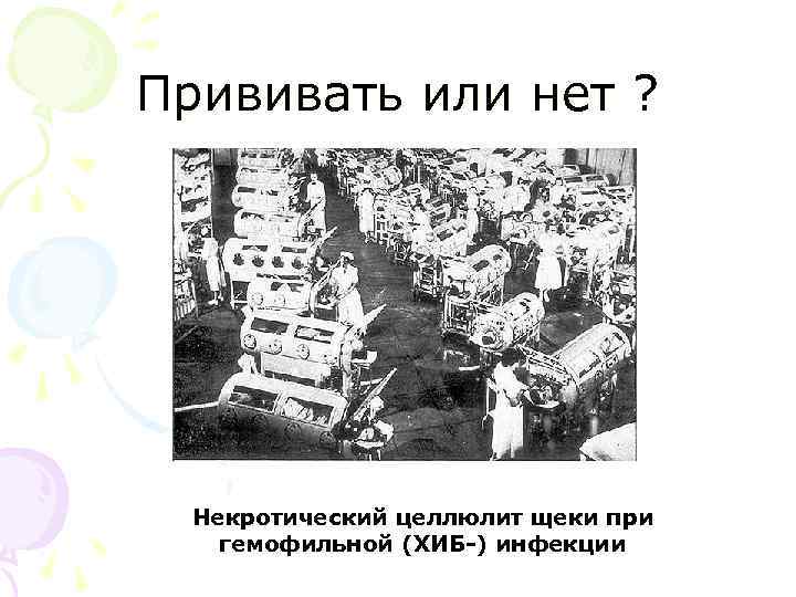 Прививать или нет ? Некротический целлюлит щеки при гемофильной (ХИБ-) инфекции 