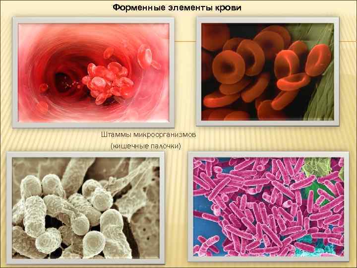 Форменные элементы крови Штаммы микроорганизмов (кишечные палочки) 