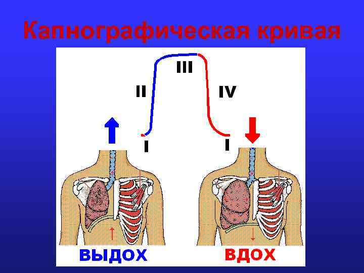 Капнографическая кривая 
