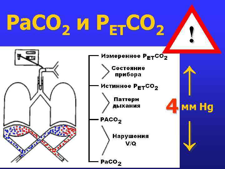 Ра. СО 2 и РЕТСО 2 ! ↑ 4 мм Hg ↓ 