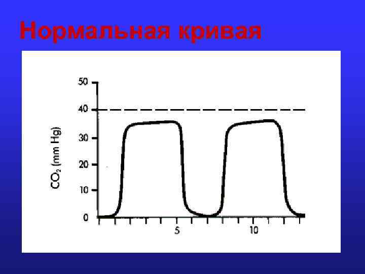 Нормальная кривая 