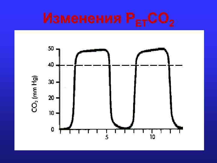 Изменения PETCO 2 