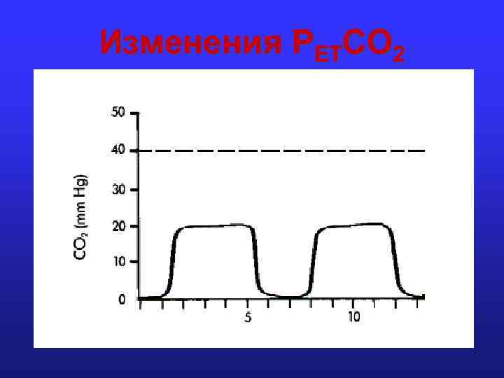 Изменения PETCO 2 