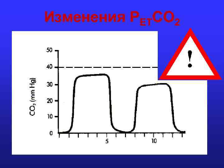 Изменения PETCO 2 