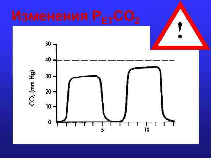 Изменения PETCO 2 