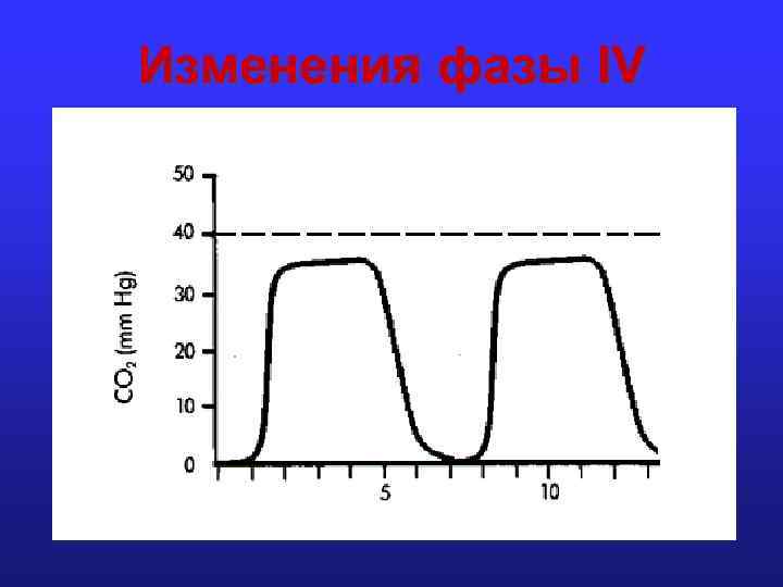 Изменения фазы IV 