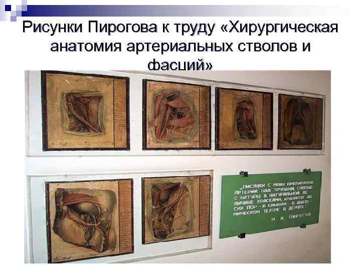 Рисунки Пирогова к труду «Хирургическая анатомия артериальных стволов и фасций» 