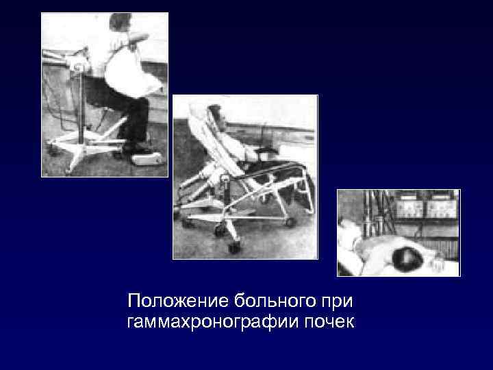 Положение больного при гаммахронографии почек 