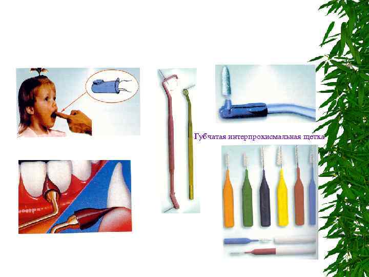 Губчатая интерпрокисмальная щетка Полтава, 1999 - 192 с. 