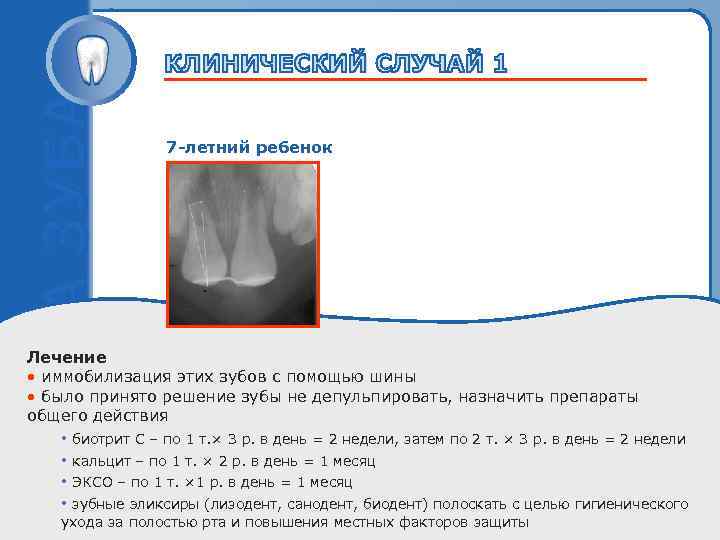 7 -летний ребенок Пробный текст Лечение • иммобилизация этих зубов с помощью шины •