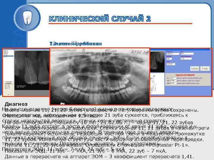 12 -летний ребенок 7 -летний ребенок Пробный текст Диагноз На рентгенограмме 21, 22 зубов