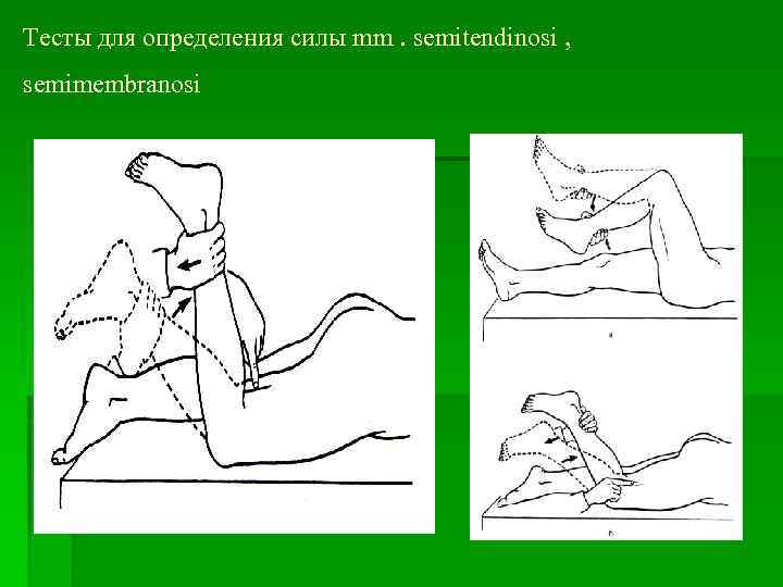 Тесты для определения силы mm. semitendinosi , semimembranosi 