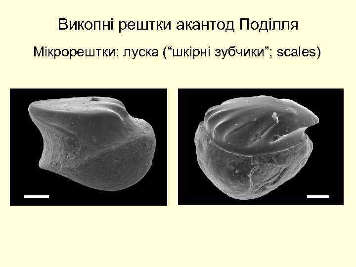 Викопні рештки акантод Поділля Мікрорештки: луска (“шкірні зубчики”; scales) 200 мкм 