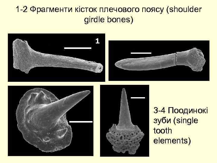 1 -2 Фрагменти кісток плечового поясу (shoulder girdle bones) 500 мкм 1 2 4