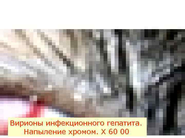 Вирионы инфекционного гепатита. Напыление хромом. Х 60 00 