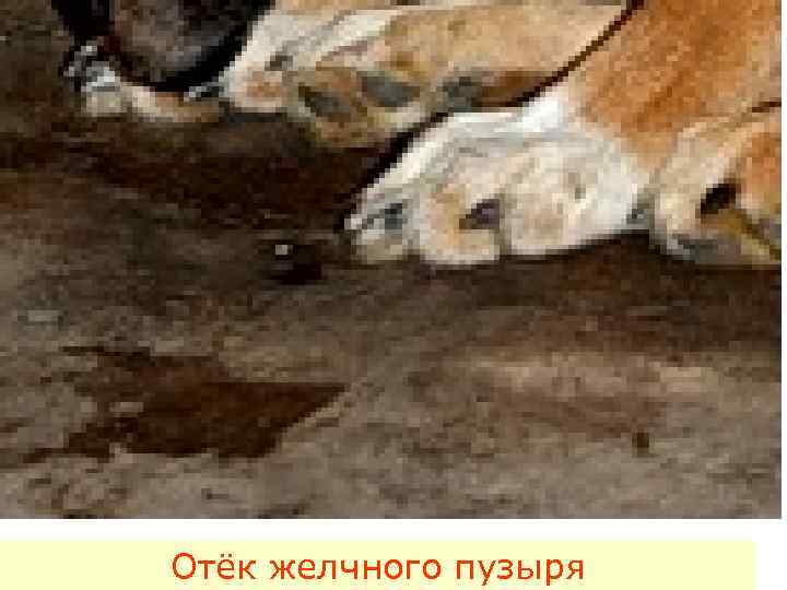 Отёк желчного пузыря 