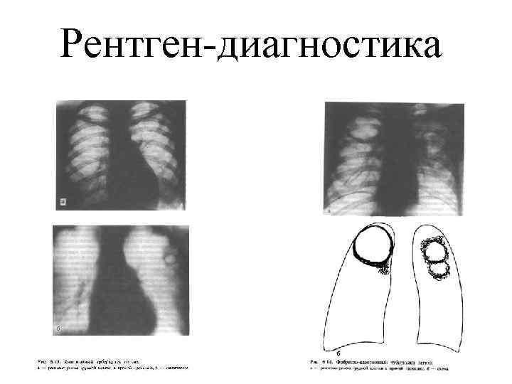 Рентген-диагностика 