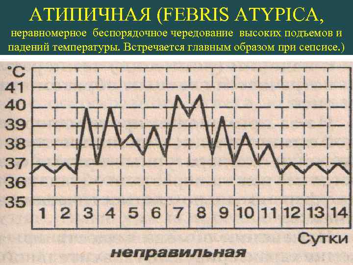 АТИПИЧНАЯ (FEBRIS ATYPICA, неравномерное беспорядочное чередование высоких подъемов и падений температуры. Встречается главным образом