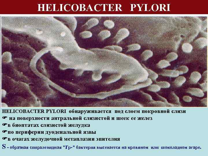HELICOBACTER PYLORI обнаруживается под слоем покровной слизи на поверхности антральной слизистой и шеек ее