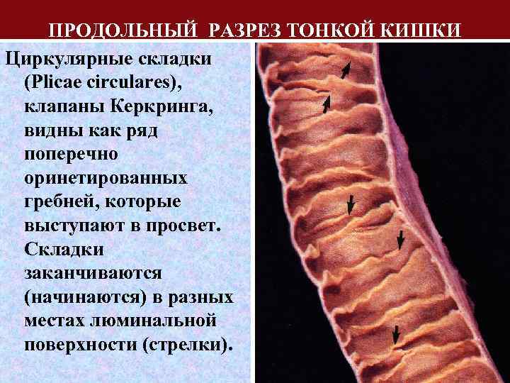 ПРОДОЛЬНЫЙ РАЗРЕЗ ТОНКОЙ КИШКИ Циркулярные складки (Plicae circulares), клапаны Керкринга, видны как ряд поперечно