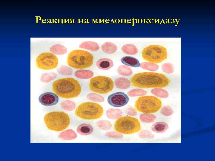Реакция на миелопероксидазу 