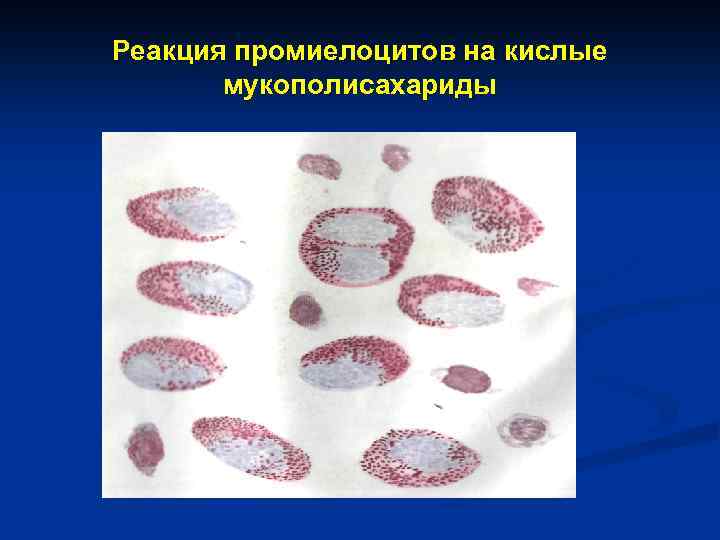 Реакция промиелоцитов на кислые мукополисахариды 