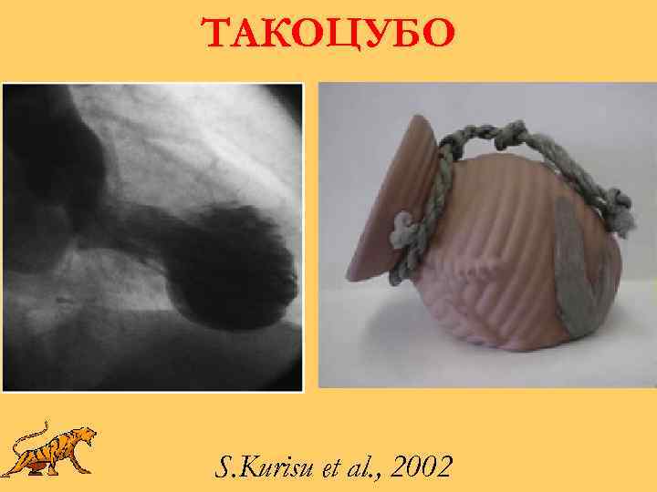 ТАКОЦУБО S. Kurisu et al. , 2002 