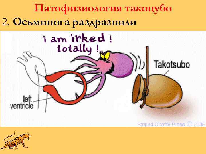 Патофизиология такоцубо 2. Осьминога раздразнили 
