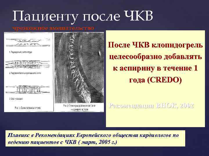 Чкв в кардиологии. Ведение пациента после ЧКВ. Чрескожное коронарное вмешательство клинические рекомендации. После чрескожного коронарного вмешательства терапия.