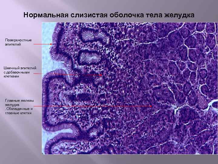  Нормальная слизистая оболочка тела желудка Поверхностные эпителий Шеечный эпителий с добавочными клетками Главные