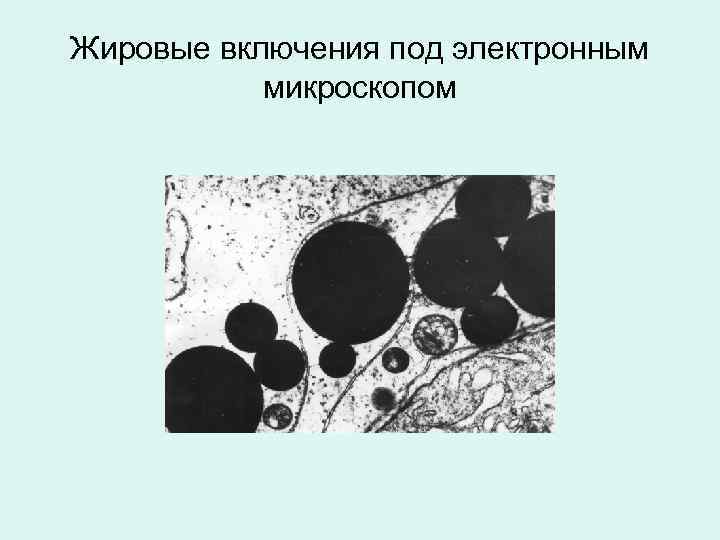 Жировые включения под электронным микроскопом 