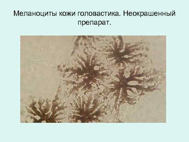 Меланоциты кожи головастика. Неокрашенный препарат. 