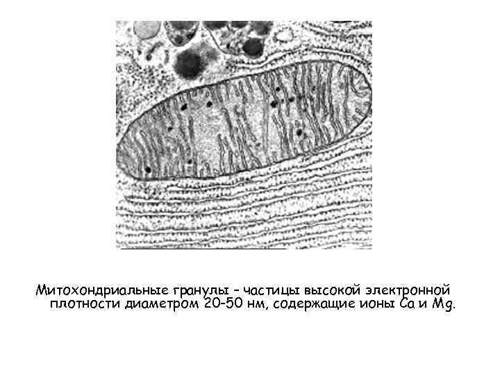Митохондриальные гранулы – частицы высокой электронной плотности диаметром 20 -50 нм, содержащие ионы Са