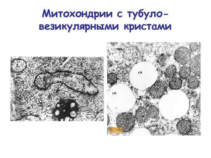 Митохондрии с тубуловезикулярными кристами 