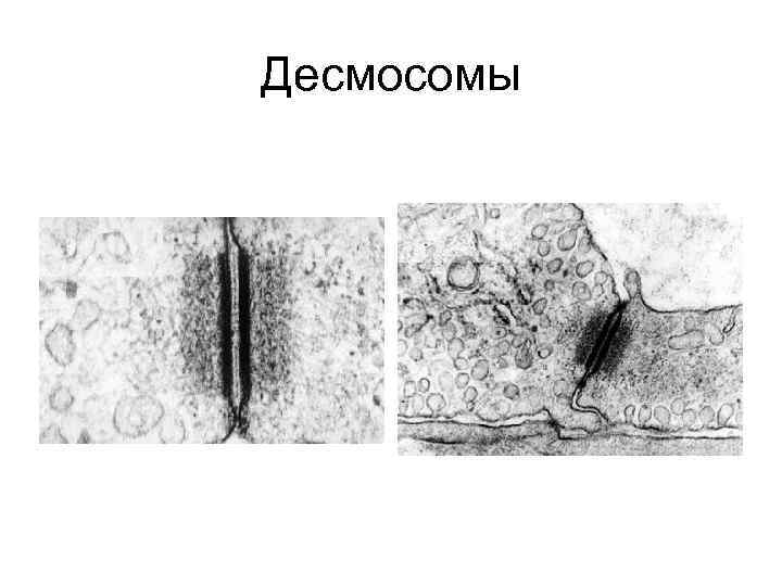 Десмосомы 